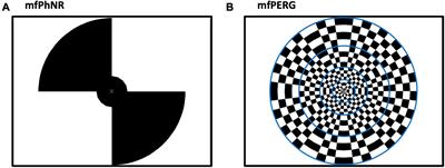 Functional and structural readouts for early detection of retinal involvement in multiple sclerosis